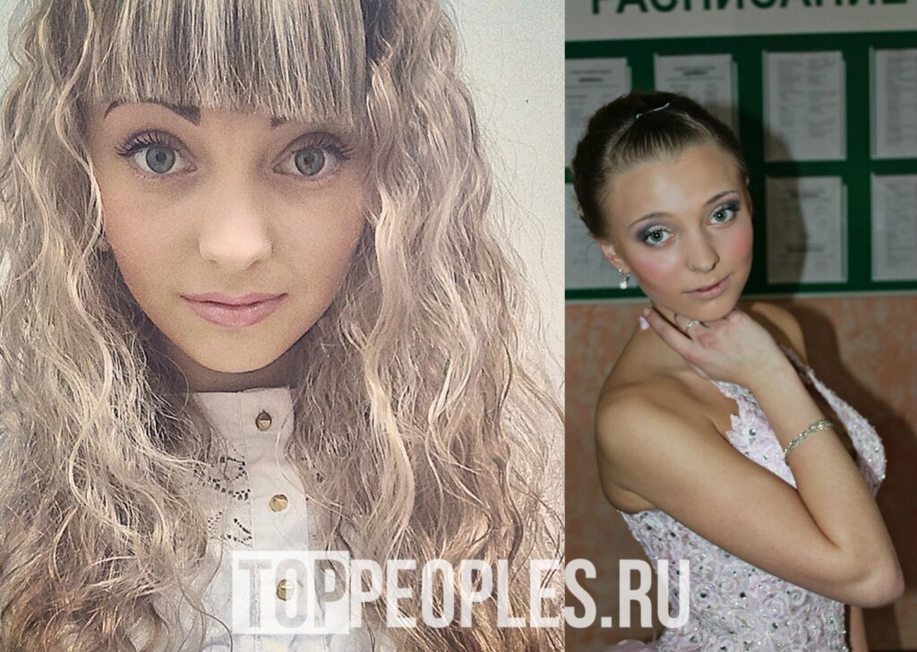 Анастасия Созоник до пластики